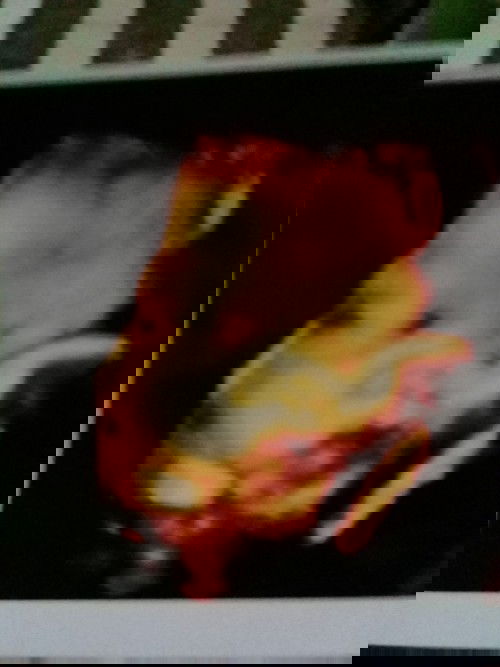 38w2d tapi belum ada tanda"