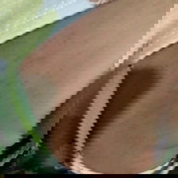 Bintik bintik merah pada bayi