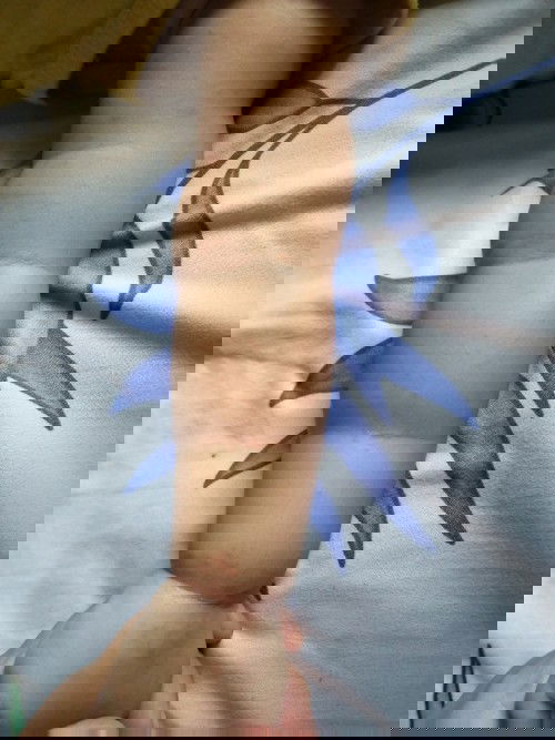 Gatal alergi atau biang keringat