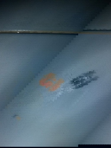 คืออะไรค่ะต้องไปหาหมอไหม