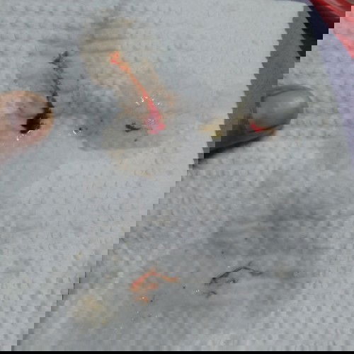 Hi Mom, sape kt sini pernah Ada darah campur kahak,tp x batuk? Dlm tmpoh pregnant.