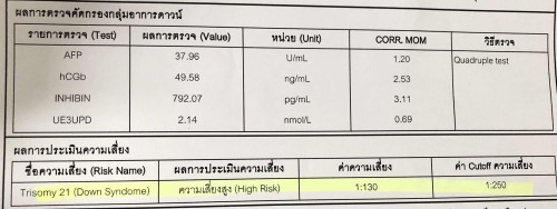 ผลตรวจเลือด QT เสี่ยงสูง