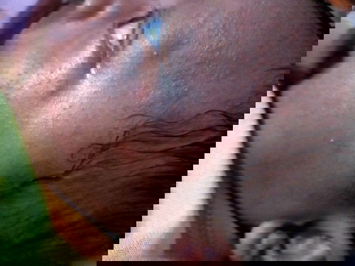 Biang keringat at apa ini?