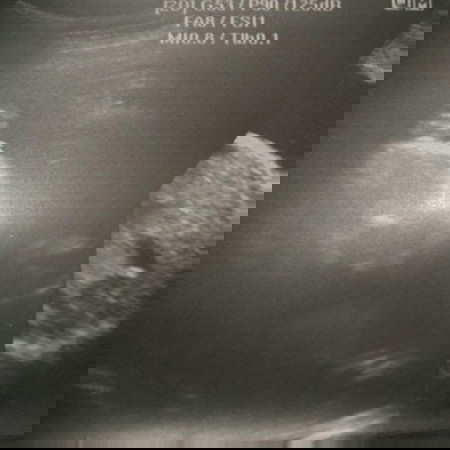 Girl o Boy?? Not sure