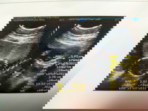 ผู้หญิงหรือผู้ชาย