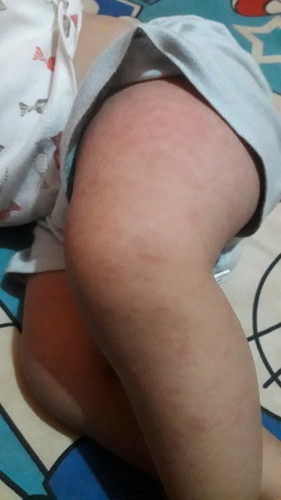 Ada yang tau ga bun ini kenapa?