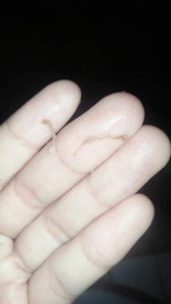 เลือดออกวันนั้น