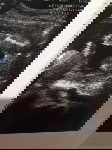 ซาวด์มามะกี้ สดๆร้อนๆป้าหมอบอกผู้หญิงร้อย% สมใจพ่อเขาล่ะ แต่ทำไมแม่เห็นเหมือนผู้ชาย😆 แม่ๆช่วยดูหน่อยค่ะ ญ หรือ ช ท้องแรก
19วีค6วัน ขอบคุณล่วงหน้านะคะ