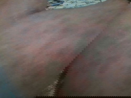 Minta solusi buat gatal gatal seluruh badan bunda, hamil 38 minggu