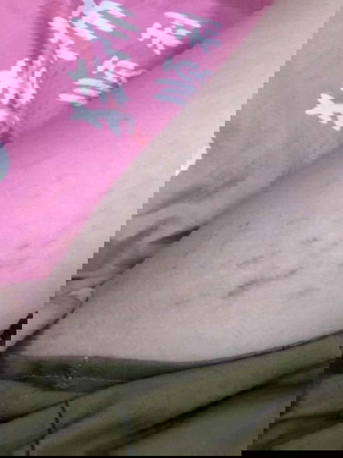 แม่ๆใช้ครีมตัวไหนทารอยแตกลายอยู่คะ?