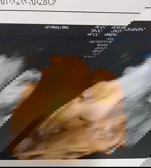 34*1 ว่าจะไม่ซาวแล้วนะ แต่อยากเห็นน่านาง