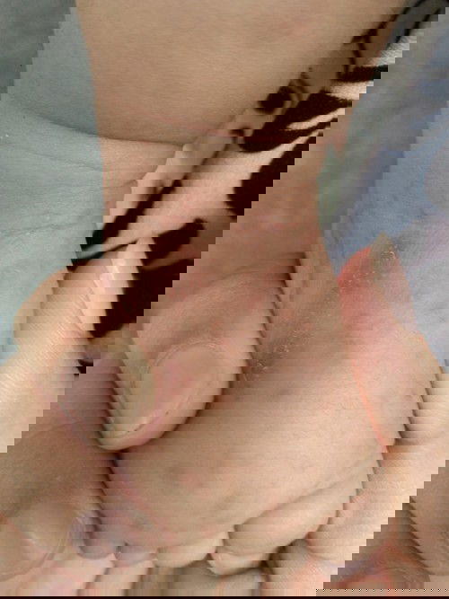 Parang butlig na makati