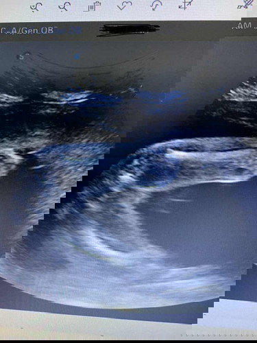 Gender scan