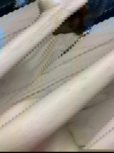 ผื่นขึ้นตาม คอแขนขา อันตราย ถึงลูกมั้ย