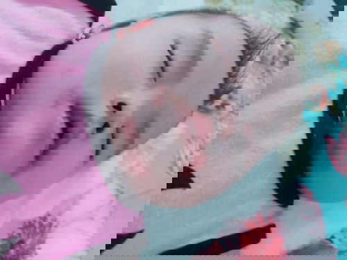 Bé bị ngứa nổi mẫn