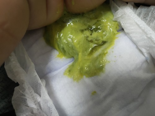 Najis bayi 1bulan warna hijau cair. breasfeeding