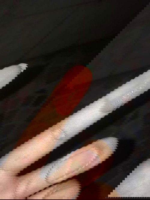 ตกขาวแบบนี้อันตรายไม่คะแล้วมันคืออะไรคะ?