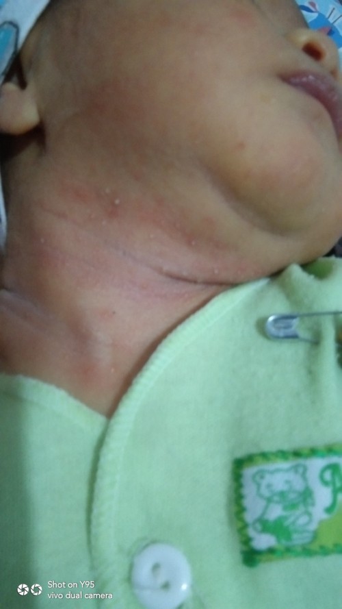 Leher kemerahan dan bintik putih