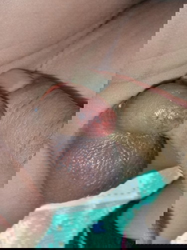 mga mommies advice nman po ano gagawin ko, nagwo worry na kc aq sa baby ko