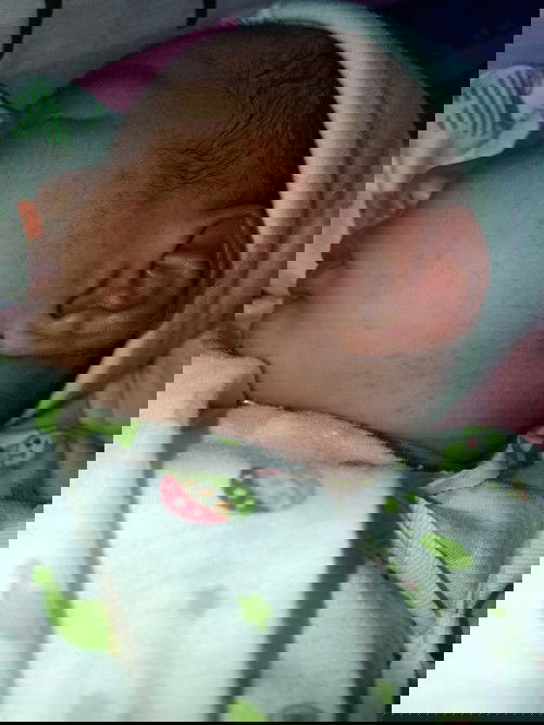 น้องเป็นผื่นแดง