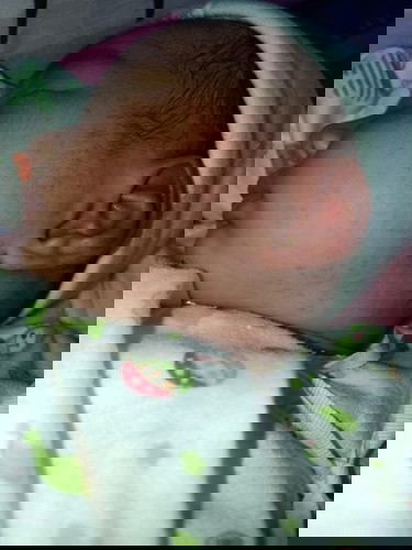 น้องเป็นผื่นแดง