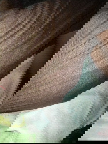 Good morning ask ko Lang po Sino po ka pariha ko po dito na sumasakit Ang butt 4months pregnant po