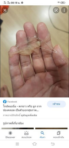 ท้องได้40+2วีคไม่มีวี่แววว่าจะออก