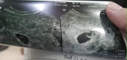 ขอสอบถามหน่อยนะคะ