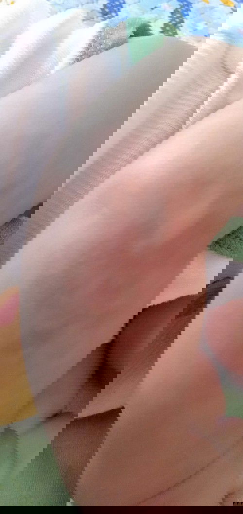 Kulit merah kehitaman