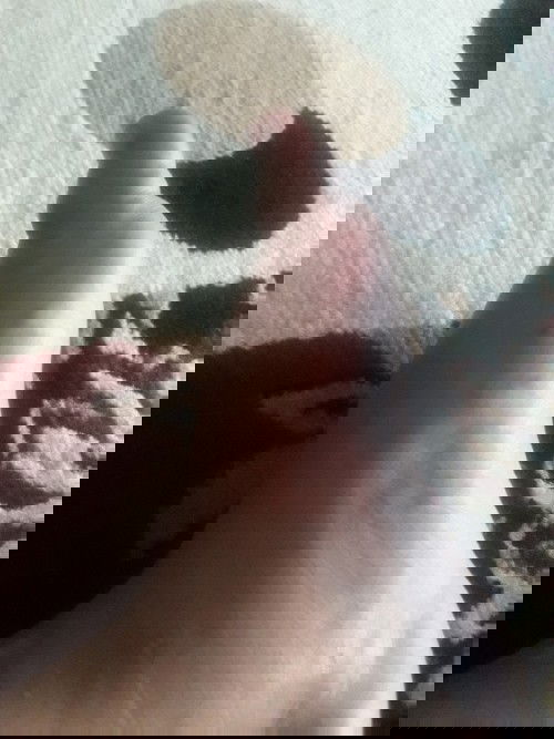 Kaki bengkak tapi tensi normal apakah dibiarkan atau mendapat penanganan dokter?