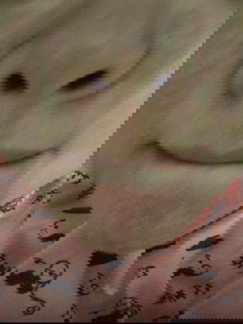 Kulit wajah bermasalah di TM 3