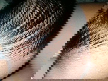 Tanong lang mga mommy's ano po kaya ito tumtubo sa nuo ng baby ko nawoworry na kasi ako