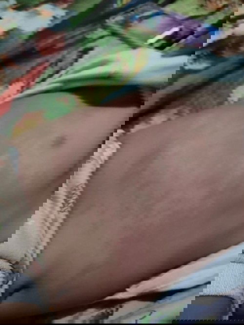 MERAH PADA BADAN DAN PUNGGUNG