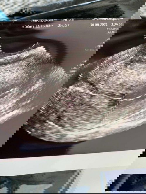 Ada line putih ditengah2