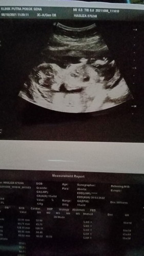 Boy or girl🤗