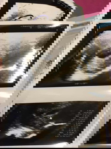 หมอบอกน้องไม่โตค่ะ