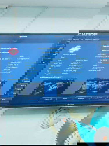 อยากสอบถามแม่ๆหน่อยจ้า ส่วนมากแม่ๆคลอดกันตามใบซาวหรือนับประจำเดือนคะ