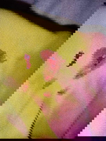 #ขอคำแนะนำค่ะ
27  w 4วัน เลือดกำเดาไหล 
ประมาณ 4-5 วันแล้วค่ะ 
อันตรายไหมค่ะ
 ท้องสอง