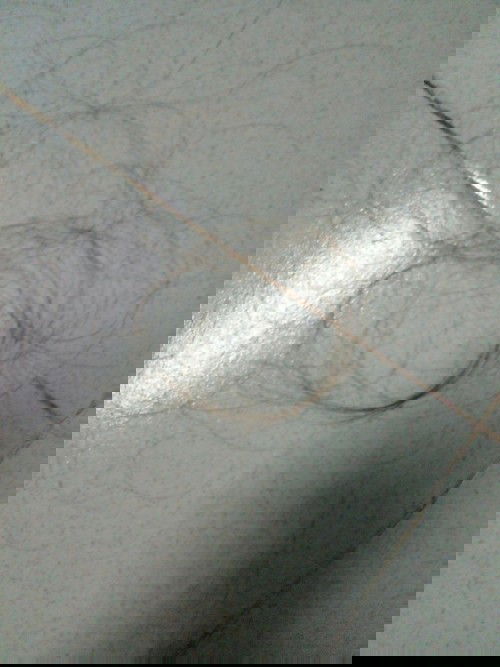 Rụng tóc sau sinh