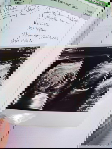 Jeniskelamin ,bund mau tanya kalo USG jenis kelamin usia 5 bulan setengah itu udah akurat blm yaa ?