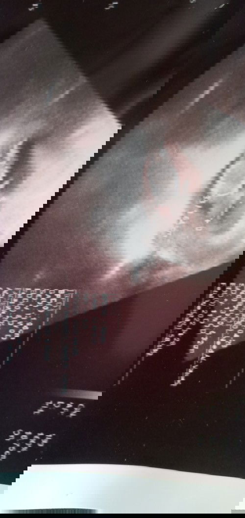 Janin lebih berat dari usianya