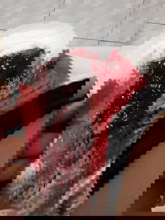 May lumalabas na bukol ang clots