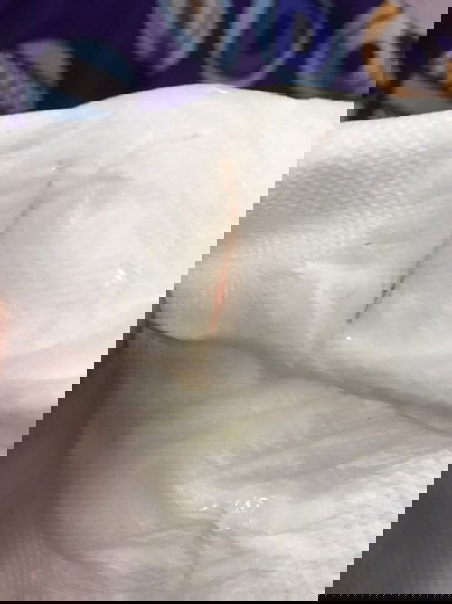 ท้อง40+2 สัปดาห์