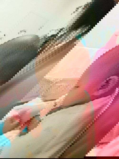 ทารกหัวแบน