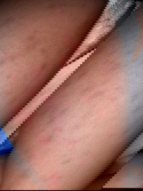 Bunda ini dikasik apa ya biar sembuh