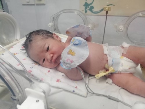 การรอคอยได้สิ้นสุดลงแล้ว 39w+2d👶🏻