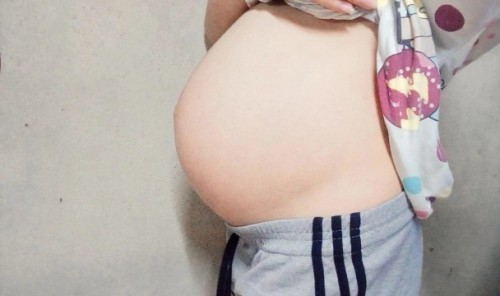 35+4 แม่บ้านไหนมีอาการปวดร้าวไปยันขาหนีบบ้างคะ