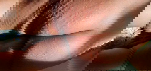 Kondisi kulit bayi 2 bulan 10 hari