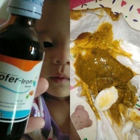 ทานยา Eurofer-lron ลูกถ่ายเป็นสีเขียวปนเลือด อันตรายไหม