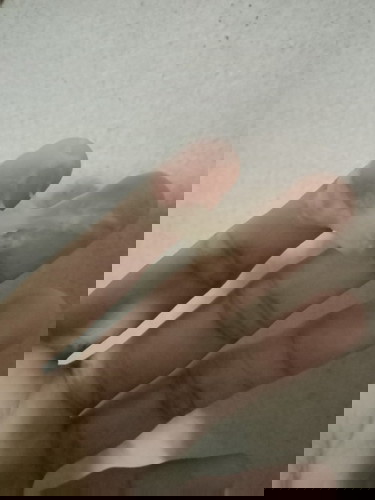 เเบบนี้ใช่มูกหรือป่าวคะไม่มีอาการปวดท้องควรไปโรงบาลไหมคะ 37+2